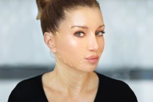 Bild zeigt die Wirkung von Vampirlifting